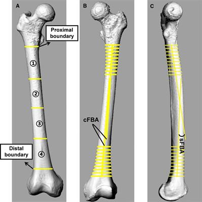 The position of entry point in total knee arthroplasty is associate with femoral bowing both in coronal and sagittal planes